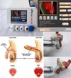 ESWT Machine de thérapie par ondes de choc Système de traitement de la douleur extracorporelle électromagnétique et traitement de la dysfonction érectile5455560