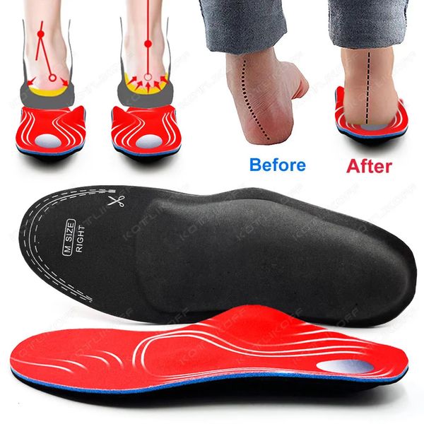 Eva Orthopedic Chaussures semelles intimes pour chaussures Arch Foot Pad xo Type Correction de jambe Plat Foot Arc Support Chaussures Sport Insert 240506