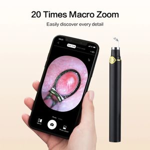 Masajeador de ojos Smart Visual Blackhead Remover Dispositivos de aguja de acné con cámara contra extractor de espinillas Exprimir herramientas para el cuidado de la piel 231130