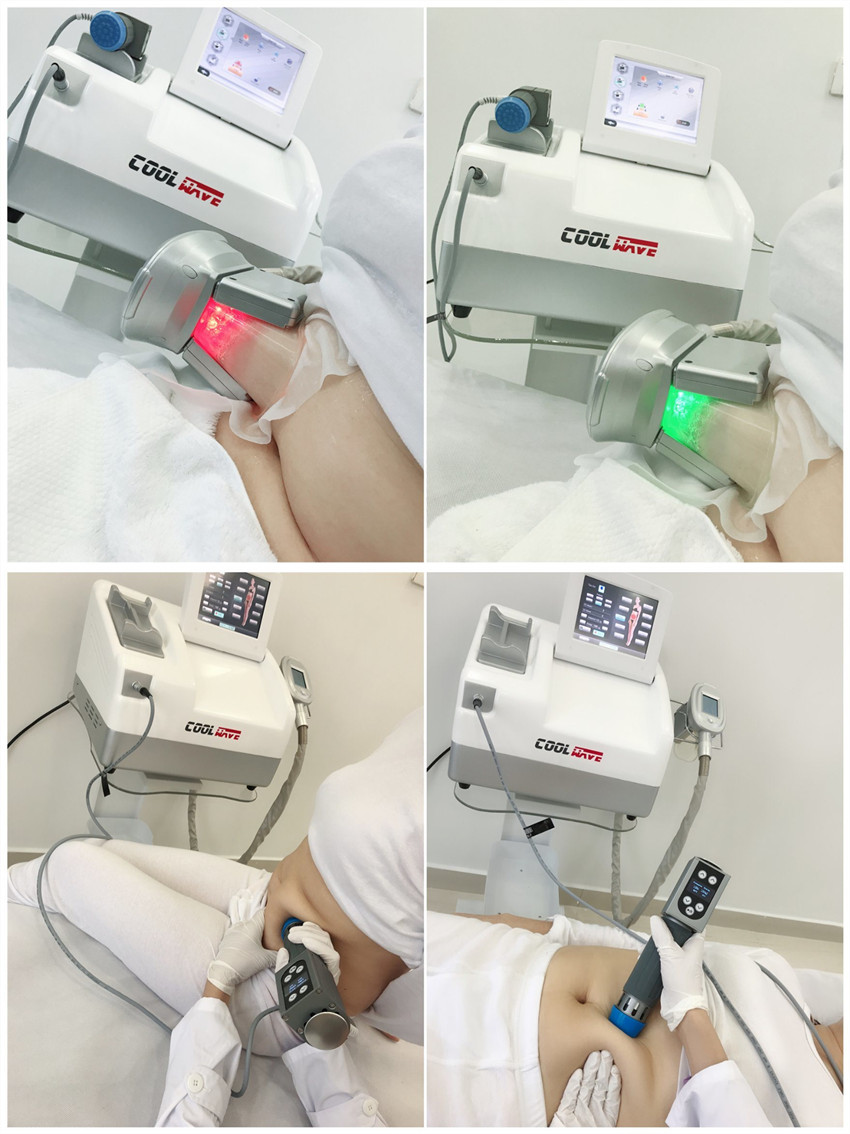 

Shock Wave Therapy Cryolipolysis Portable Fat Freezing Machine Shockwave Machine Slimming Weigth Loss ED Treatment with CE certification