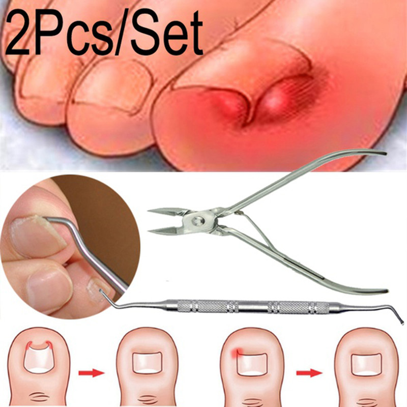 

Ingrown Foot Care Tool Toe Nail Correction Nippers Clipper Cutters Dead Skin Dirt Remover + Podiatry Pedicure Gift