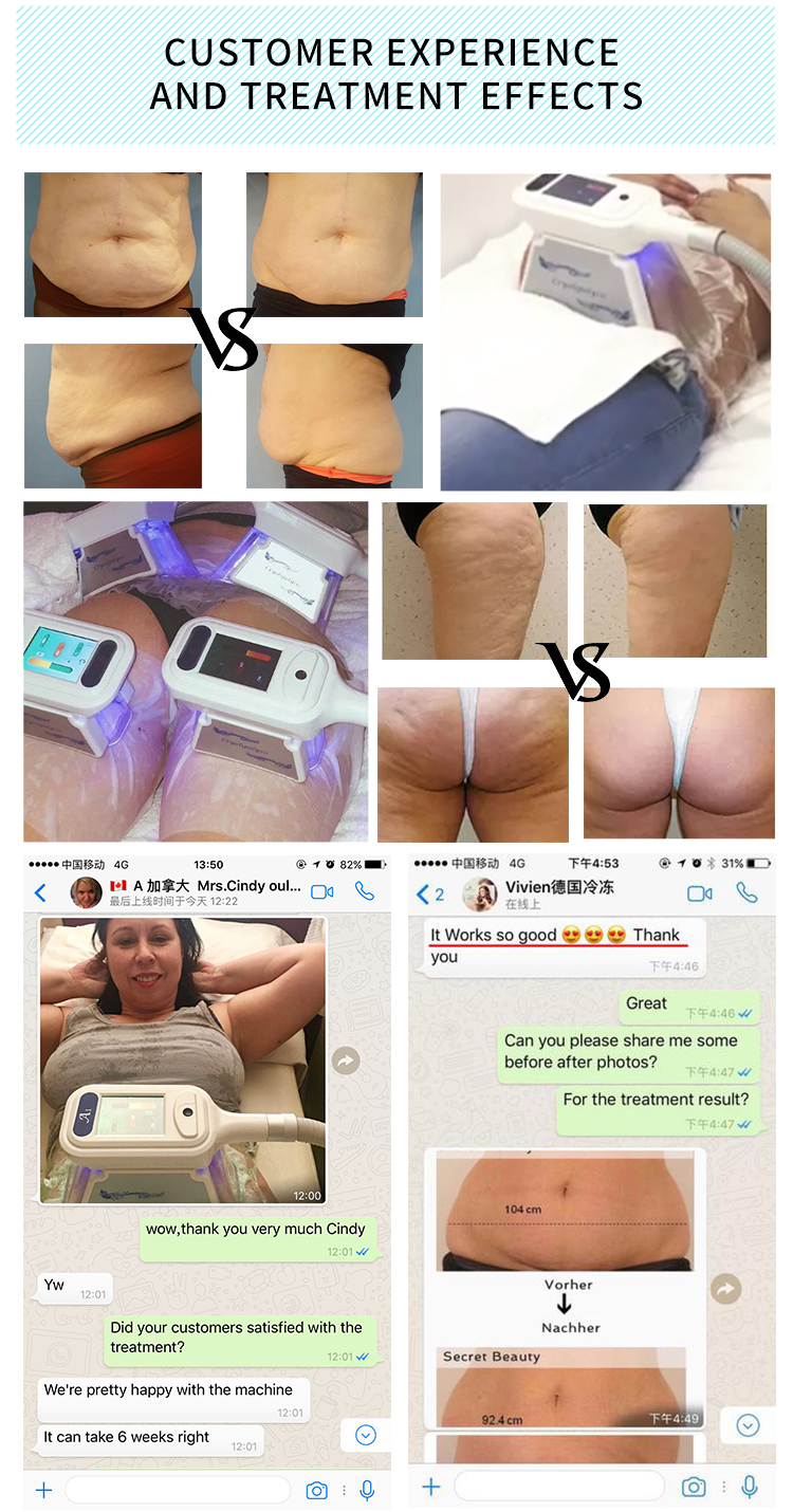 3000W High Power -15 Degree Refrigeration Cryo Pad Cryolipolysis Machine