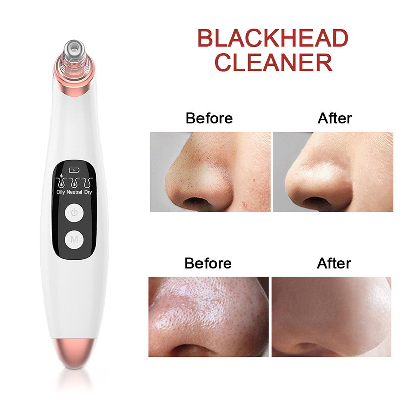 Blackhead Remover Face Deep Nose Cleaner Pore Acne Pimple Removal Vacuum Suction Facial Beauty Skin Care Tool J1248-image-571339857