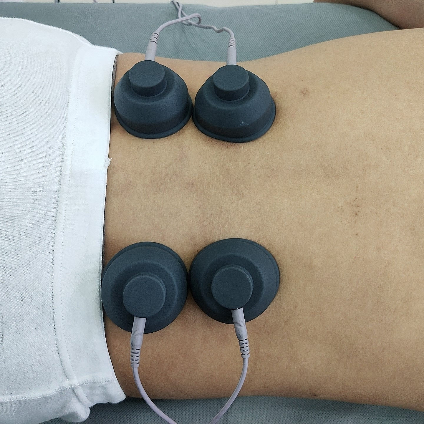 

EMS Shock medical shock wave muscle stimulaiton therapy for body paine relief weight loss ed treatment