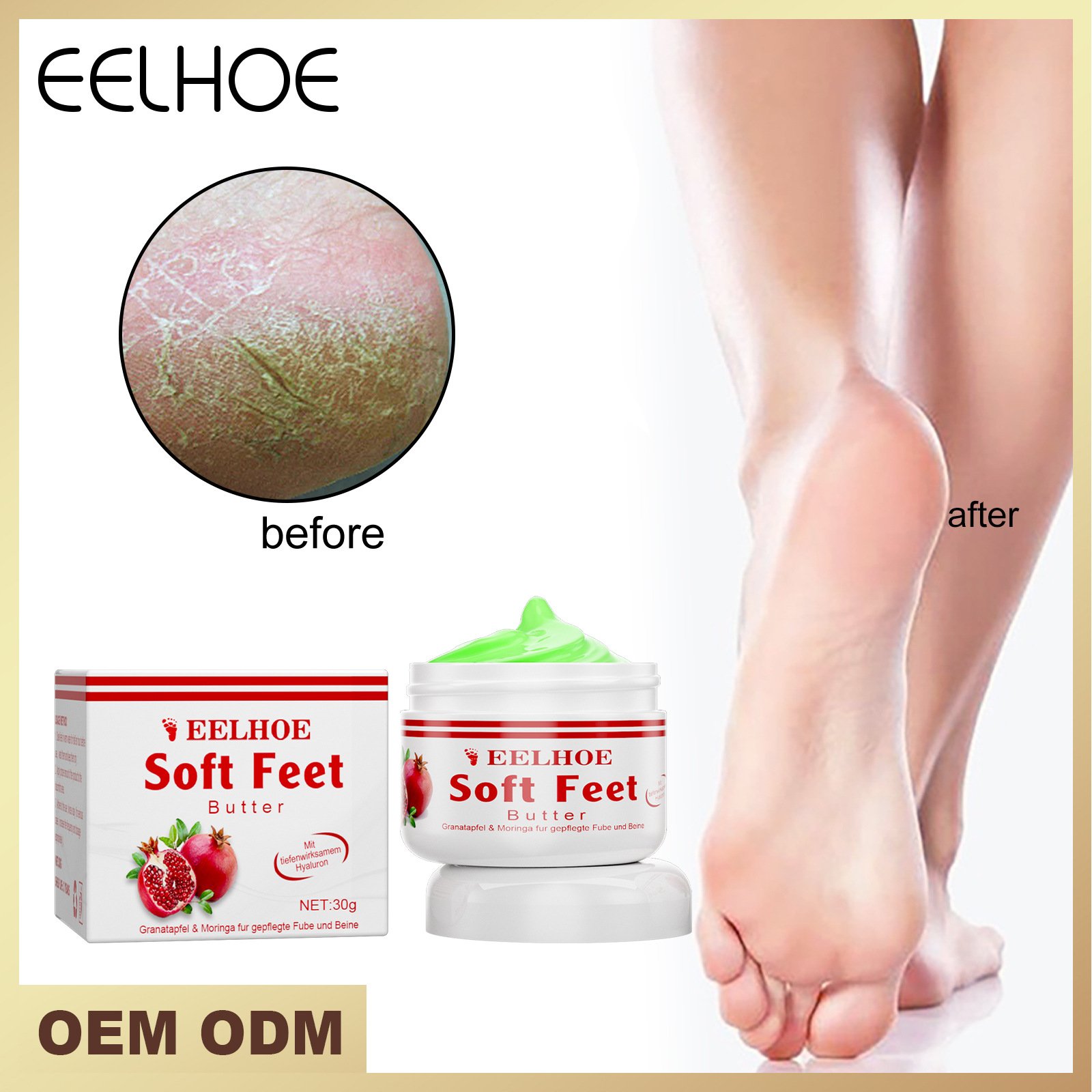 

Free freight EELHOE OEM ODM Pomegranate hand and foot cream moisturizes and repairs dry peeling and rough repair