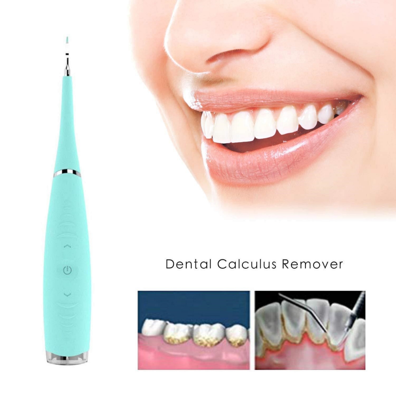 

Portable Electric Sonic Dental Scaler Tooth Calculus Remover Tooth Stains Tartar Tool Dentist Whiten Teeth Health Hygiene white