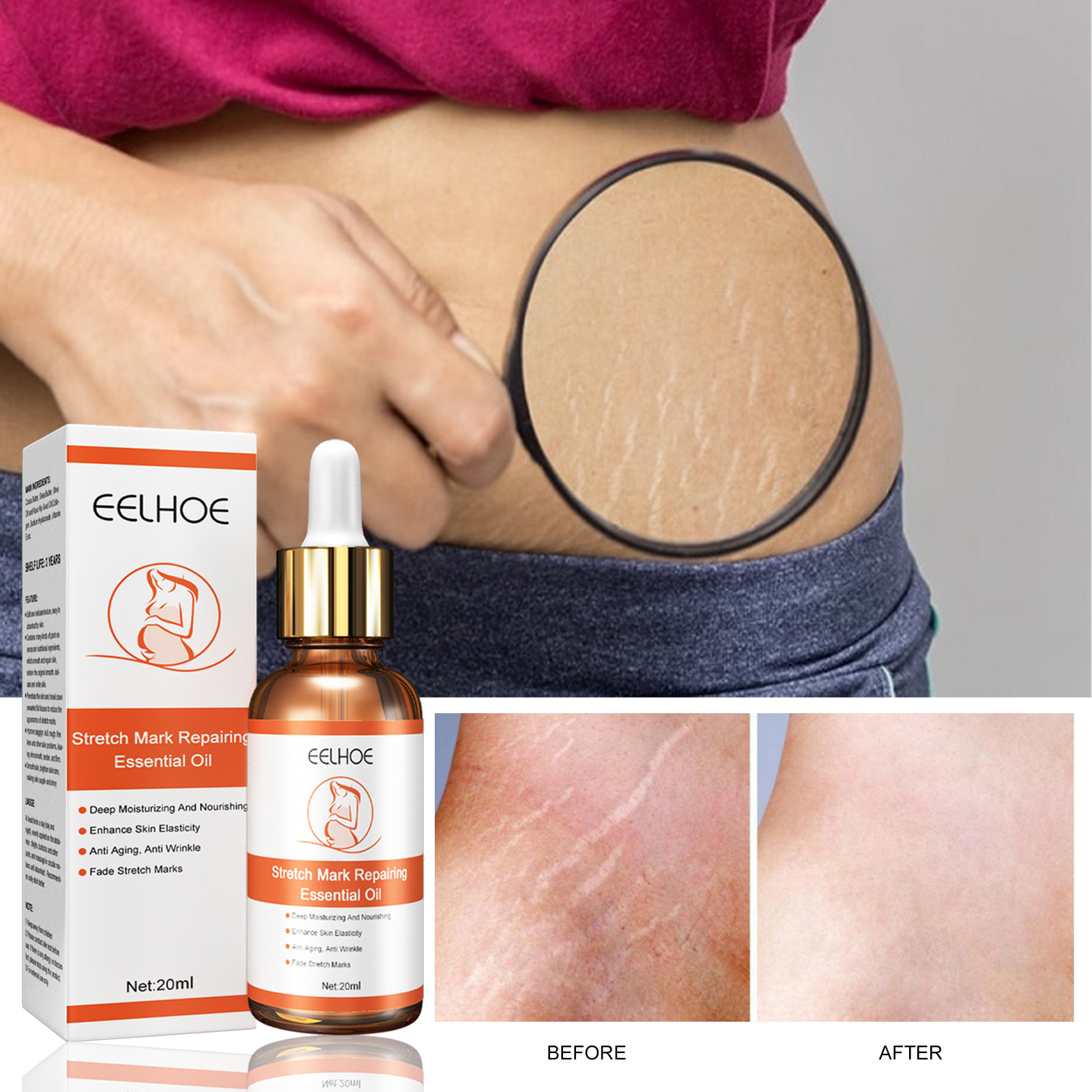 

Free freight EELHOE OEM ODM Stretch marks repair and fade essential oil skin firming and relaxation skin care essence