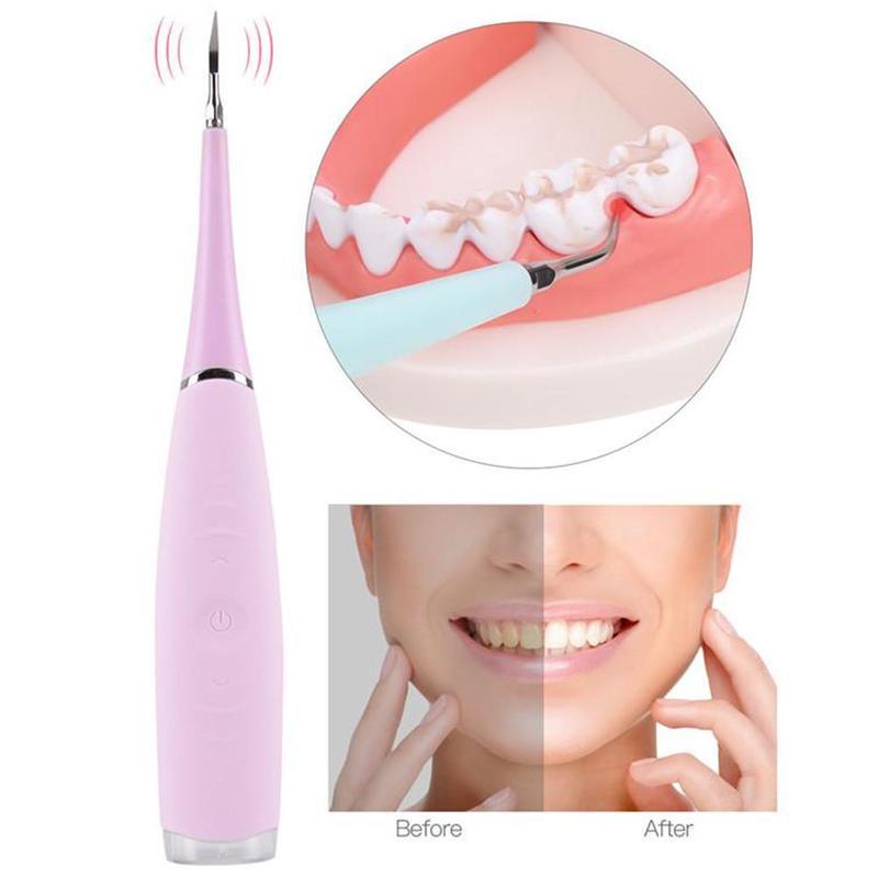 

Electric Ultrasonic Sonic Dental Scaler Tooth Calculus Remover Cleaner Tooth Stains Tartar Teeth Remove Oral Cleaner