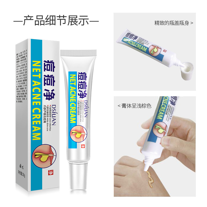 Herbal Effective Acne Remover Cream Natural Plant Acne Treatment Fade Acne Spots Cream Oil Control Shrink Pores Skin Care P-image-755797656