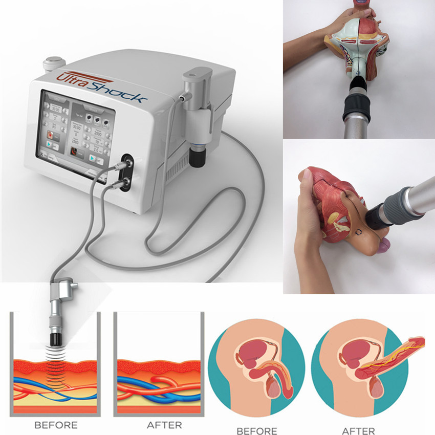 

Portable ultrashock Orthopaedics Acoustic Shock Wave machine for ED/ESWT pneumatic shockwaveshockwave therapy machine hot selling