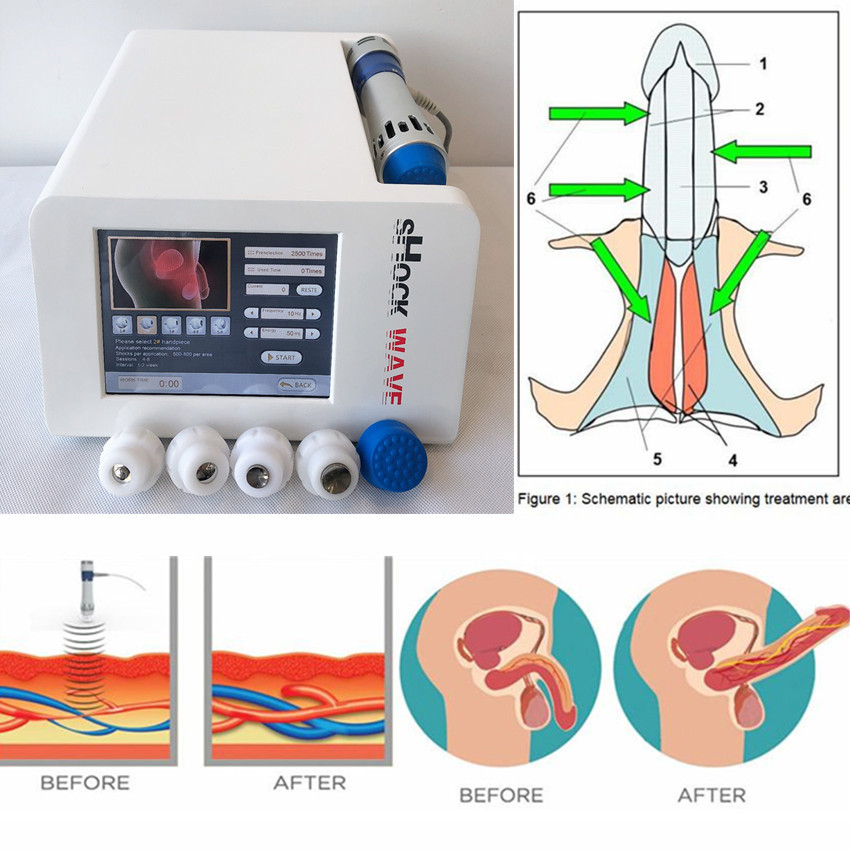 

Home use ED shockwave physiotherapy device for men prostate/ portable ESWT Acoustic radial wave for Erectile Dysfunction treatment