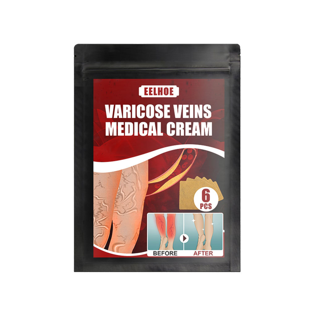 Free freight eelhoe Vein massage varicose plaster leg swelling earthworm leg vein massage pain relief-image-750802496