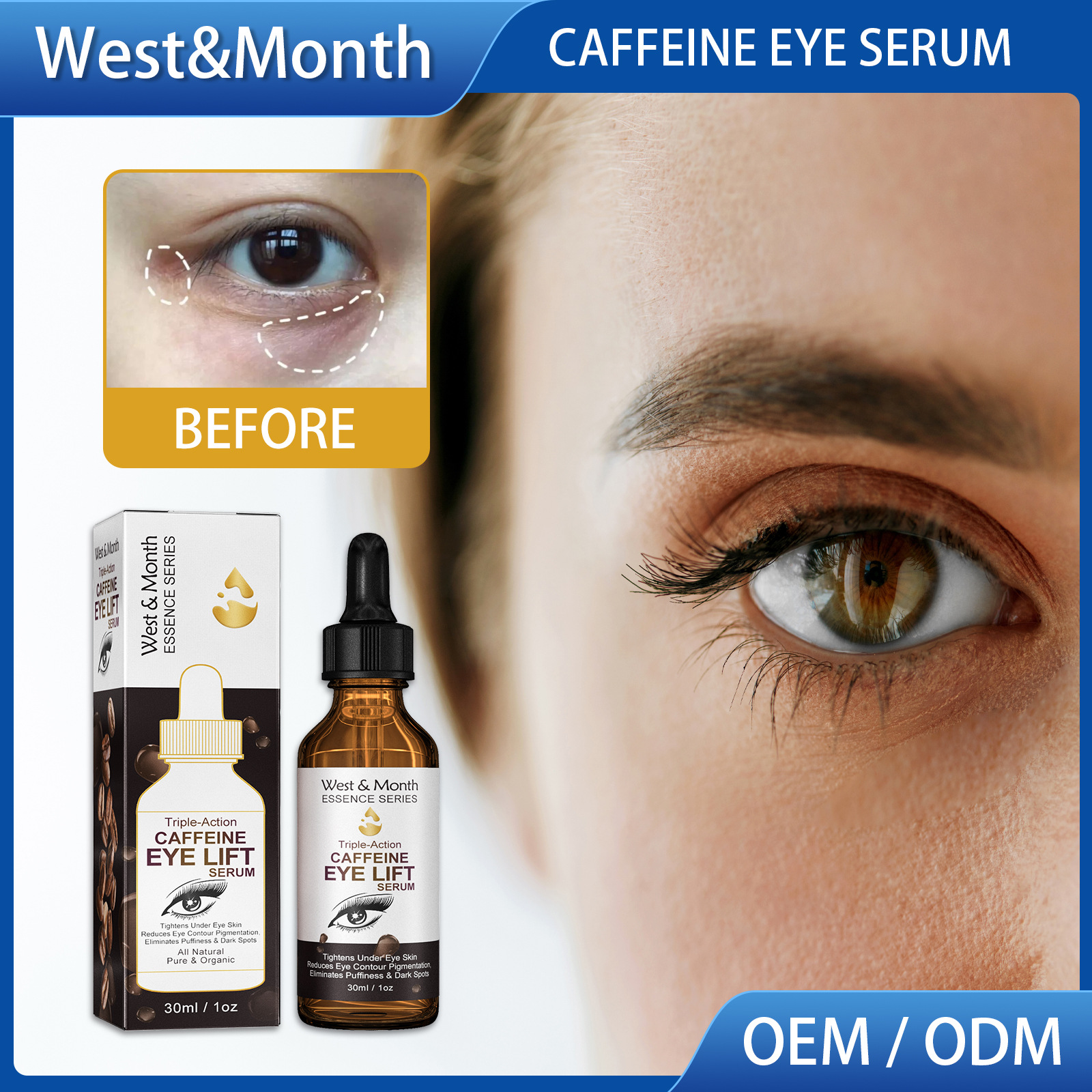 Free freight West&Month OEM ODM Eye Care Essential Oil Fade Eye Bags Dark Circles Fine Lines Crow's Feet Massage Essence-image-754654737