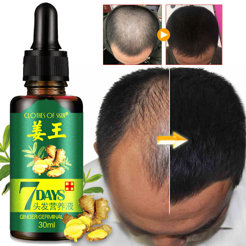 

7 Day Hair Growth Essence Germinal Serum Essence Oil Natural Hair Loss Treatement Effective Fast Growth Hair Care 30ML
