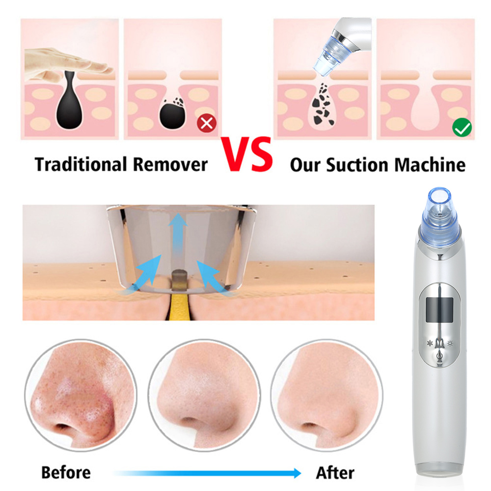 

Blackhead Remover Pore Vacuum Electric Blackhead Vacuum Cleaner Blackhead Extractor Tool Device with 5PCs Acne Removing ToolsScouts