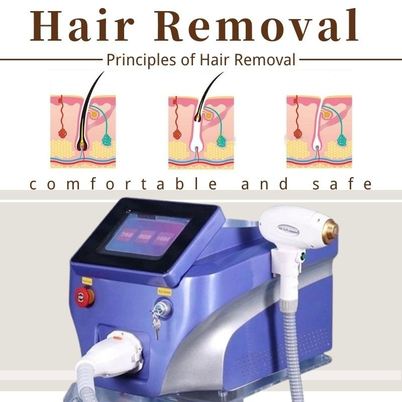 2022 Alma Ice Platinum 755 1064 808Nm Diode Laser Hair Removal Machine Price