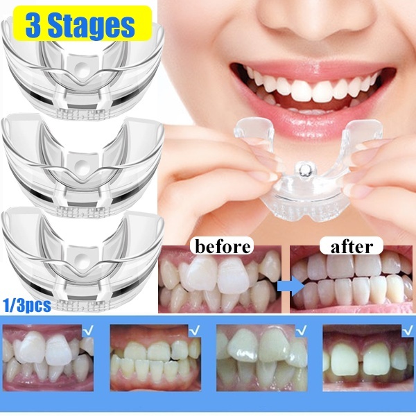 

3 Stages Dental Orthodontic Teeth Silicone Braces Appliance Trainer Corrector Alignment Trainer for Adults Tooth Care Tool