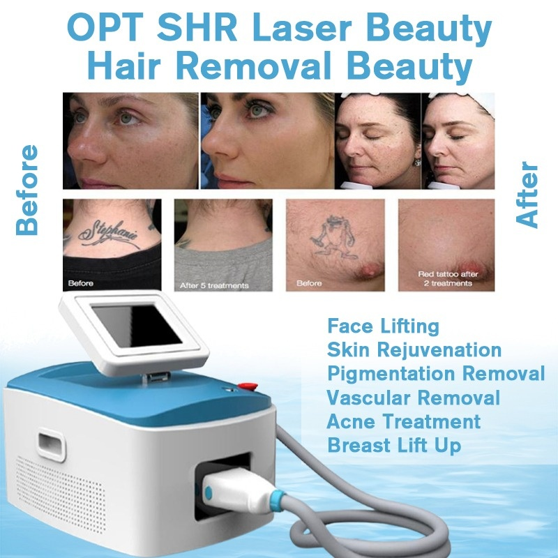 

2015 Newest Vertival Rf Skin Rejuvenation E-Light Laser Hair Removal Device Price Ipl Equipments