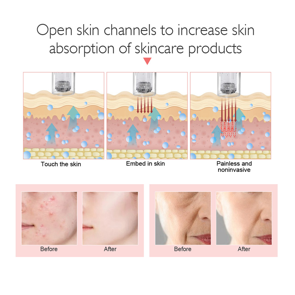 

Wireless Microneedling Pen for Beauty with Screw Cartridge Microneedeling Pen Derma Microneedle Cartidge Needle MesotherapyScouts