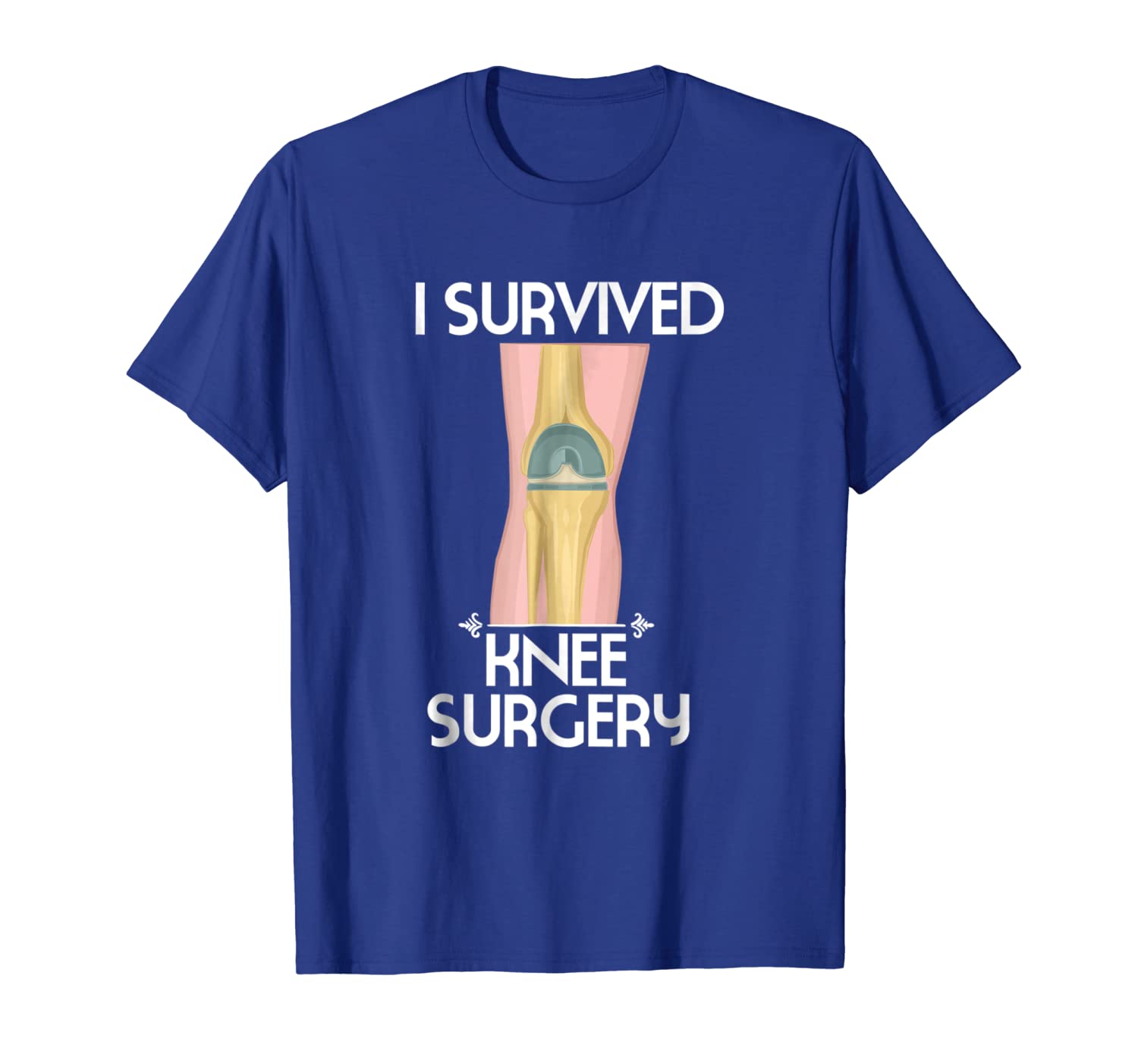 

knee surgery gift: i survived knee surgery t-shirt, White;black