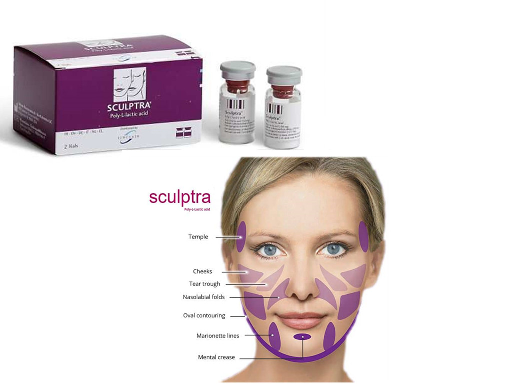 

buy online (2vials*150mg) aesthetic sculptra injection derma filler