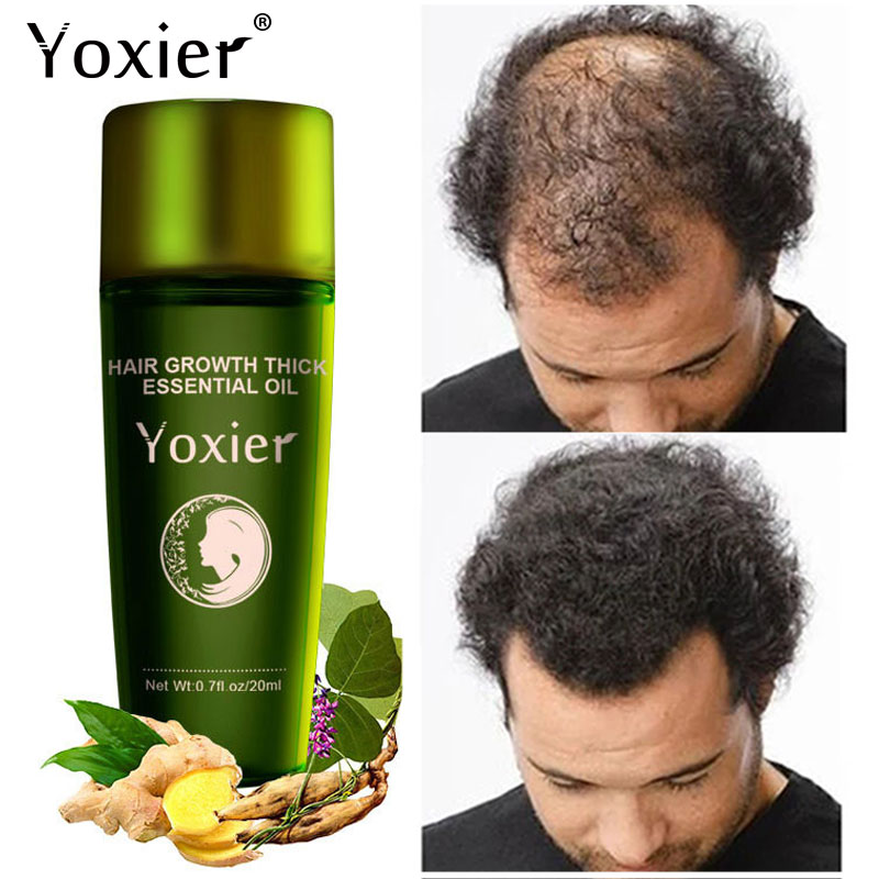 

Yoxier Herbal Hair Growth Essential Oil Shampoo hair care styling Loss Product Thick Fast Repair Growing Treatment Liquid