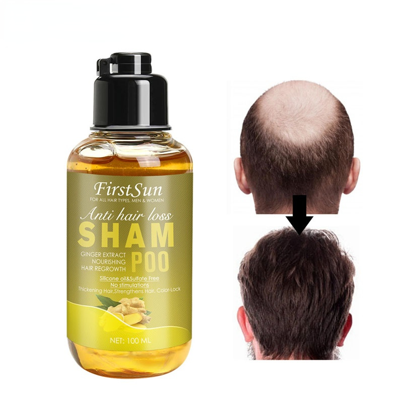 

Anti Hair Loss Shampoo Herbal Ginger Ginseng Extract Hair Essence Treatment Dry Frizz Regrowth Thicken Hair Product