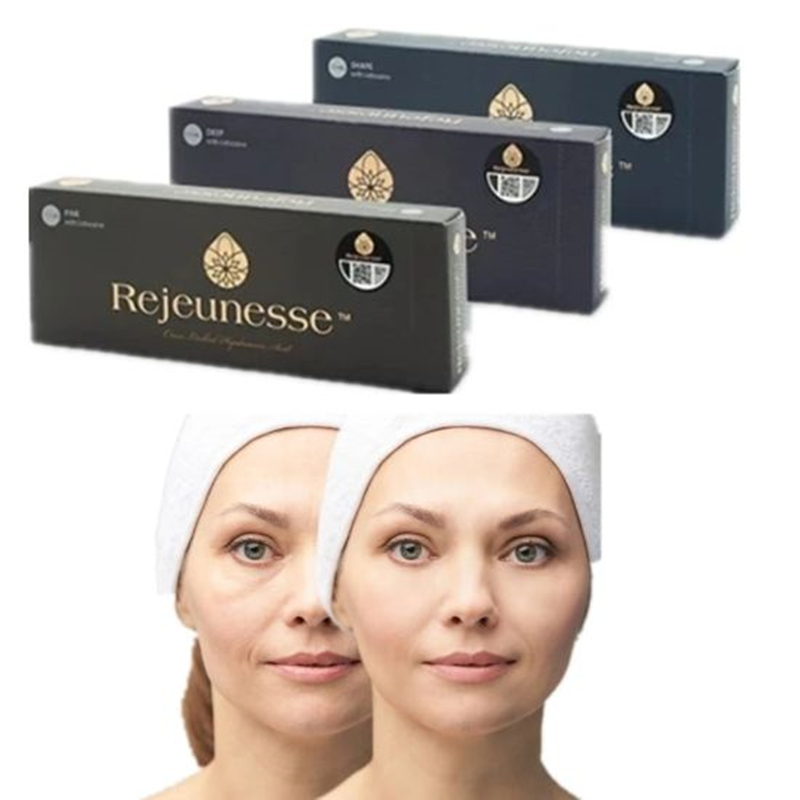 

Beauty Items Rejeunesse for Cross-linked HA dermal Filler