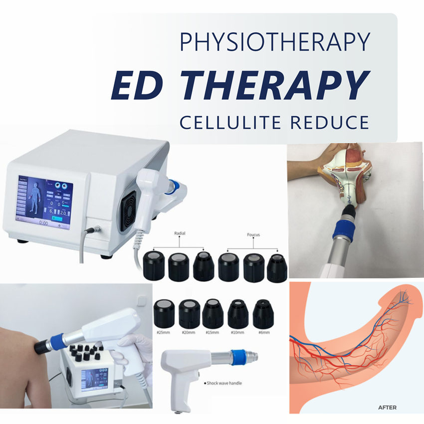 

Portable Shock wave therapy for Body Pain relief /portable Professional ShockWave Physiotherapy machine to ED treatment