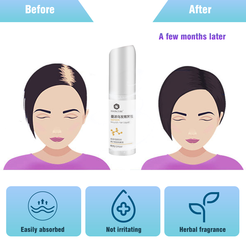 

3Pc Fast Hair Growth Essence Oil Spray Anti Hair Loss Treatment Help for hair Growth Care Products for Men Women TonicScouts