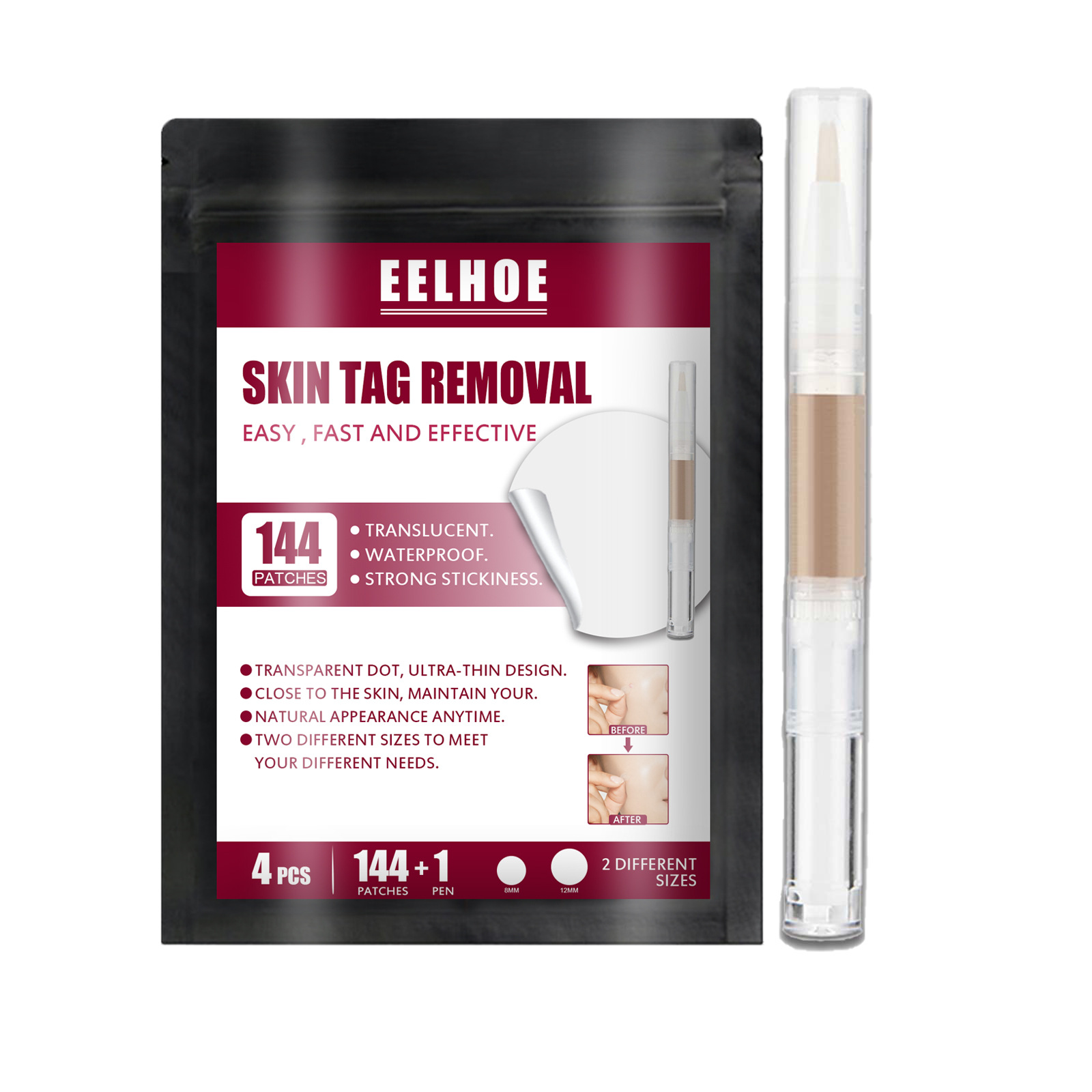 Free freight eelhoe Repairing and nursing face especially flat wart removing paste-image-750207704
