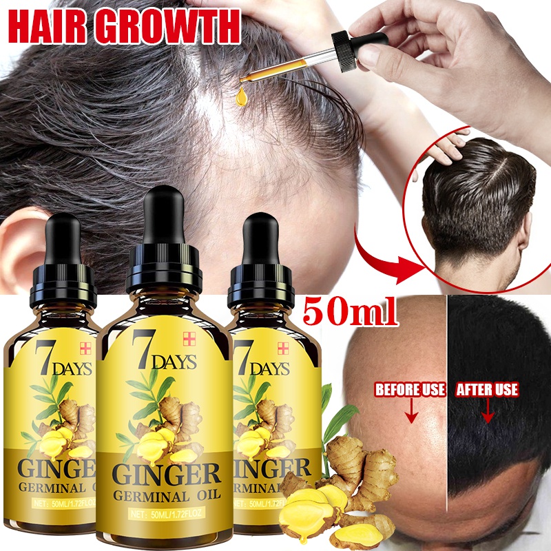 

Accessories 50ml Hair Growth Products Ginger Fast Growing Hair Essential Oil Beauty Hair Care Prevent Loss Oil Scalp Treatment For Men