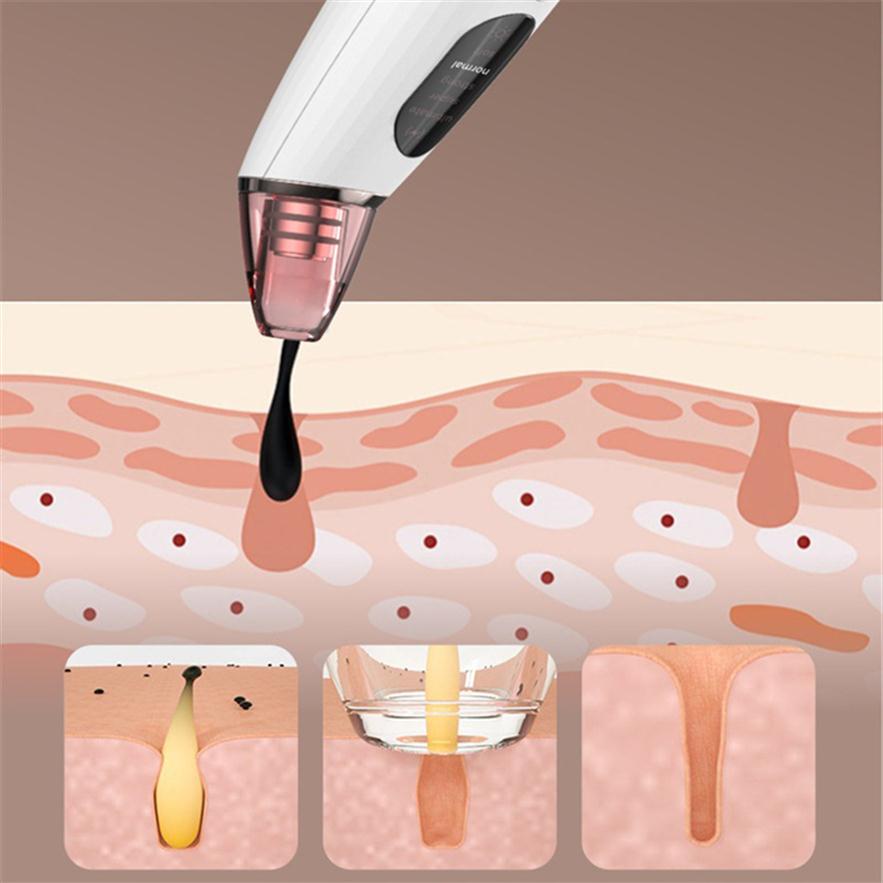 

Blackhead Instrument Home Handheld Portable Facial Skin Cleaner Blackhead Exporter242S