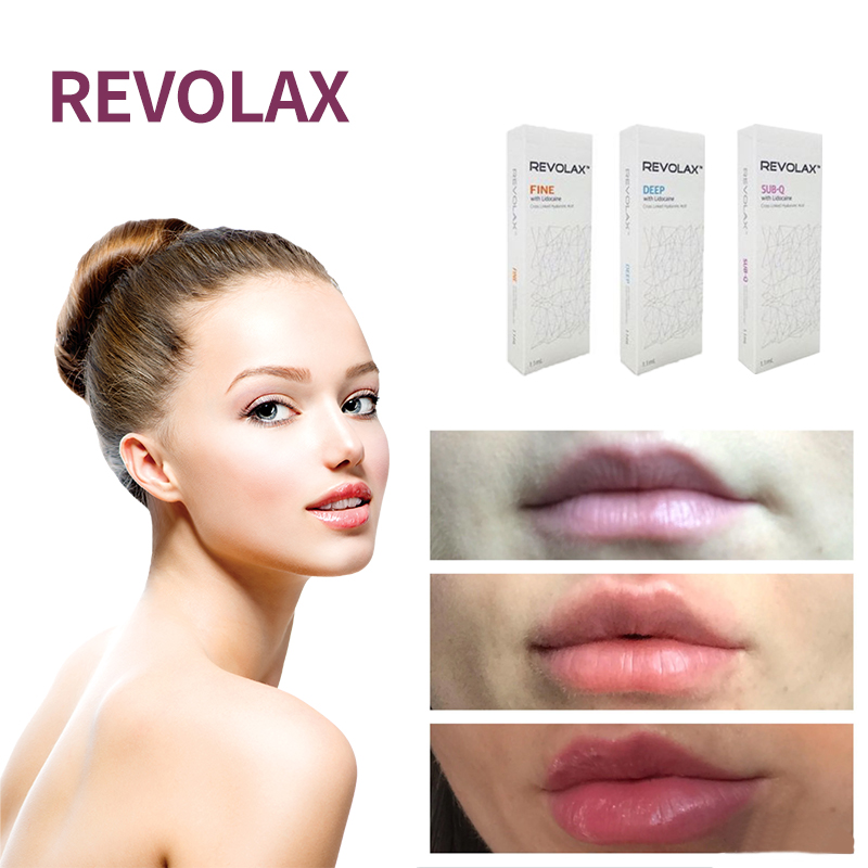 

Sculpting & Slimming Beauty Items 1.1ml Revolax Fine Deep Sub-Q dermal filler