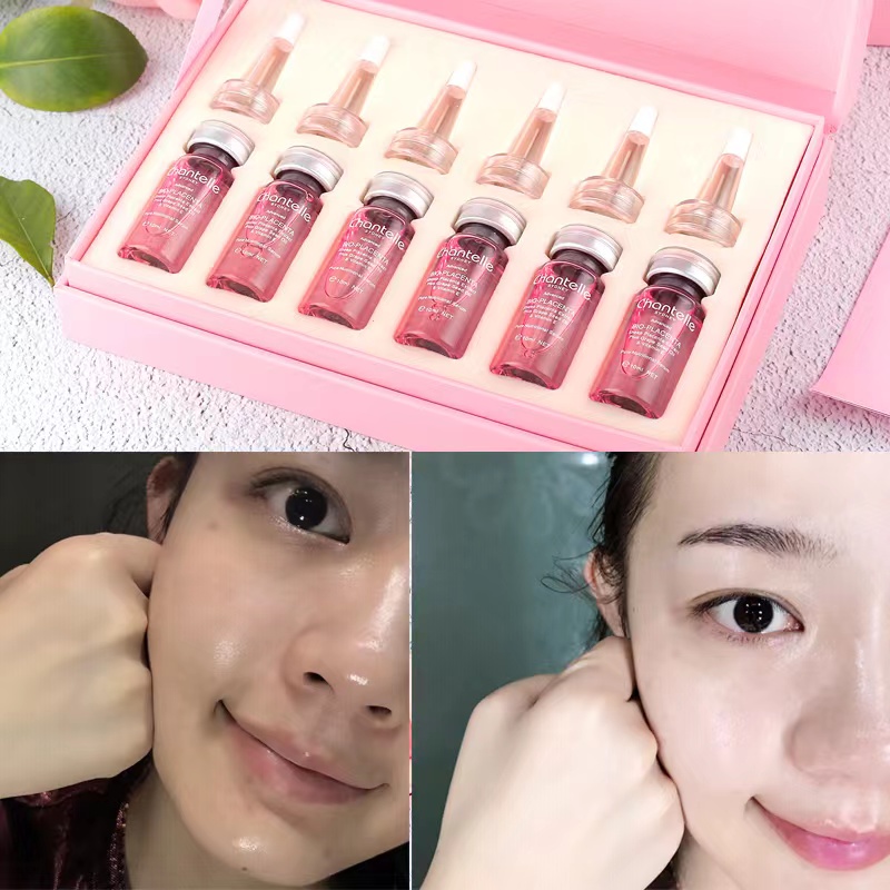 

Original Facial Serum for Beauty Microneedle Roller Face Treat Anti-gravity Anti-aging Reduce Age Spot Pigmentation Firmer Tighter Skin