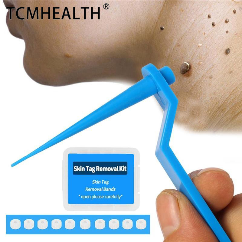 Medical Micro Skin Tag Remover Mole Wart Band Facial Tag Removal Kit With Cleansing Swabs-image-760630947