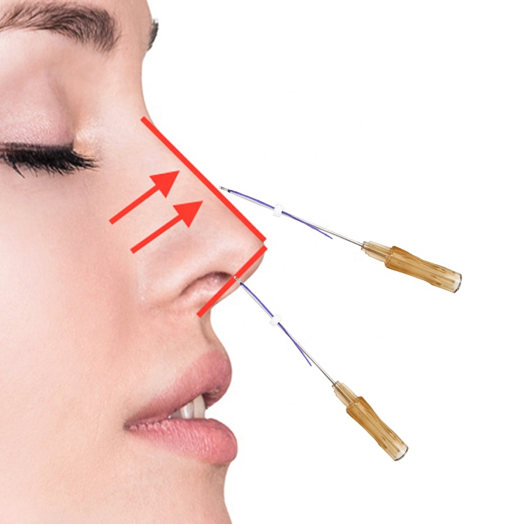 

Nose PDO Thread Lift 4D Cog With L Blunt Cannula For Nose