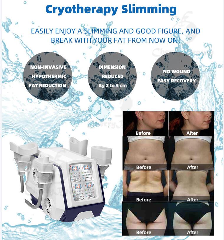 360 Degree Cooling Cryotherapy Cryolipolysis Professional Body Slimming Machine For Face Body Belly Stomach Legs Arms Cellulite Removal Beauty Eq-image-794313511