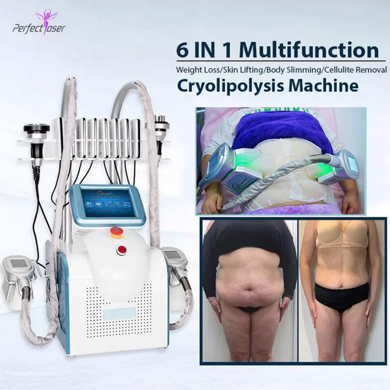 

80K Lipolaser cryolipolysis cavitation machine cryo fat freezing cavitation weight loss RF skin rejuvenation cool slim device