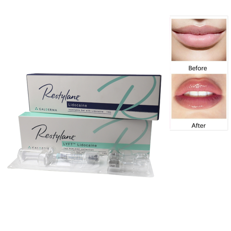 

Beauty Items lip facial fillers Restylane Lyft Kysse HA Crosslinked Sculptra Dermal Filler