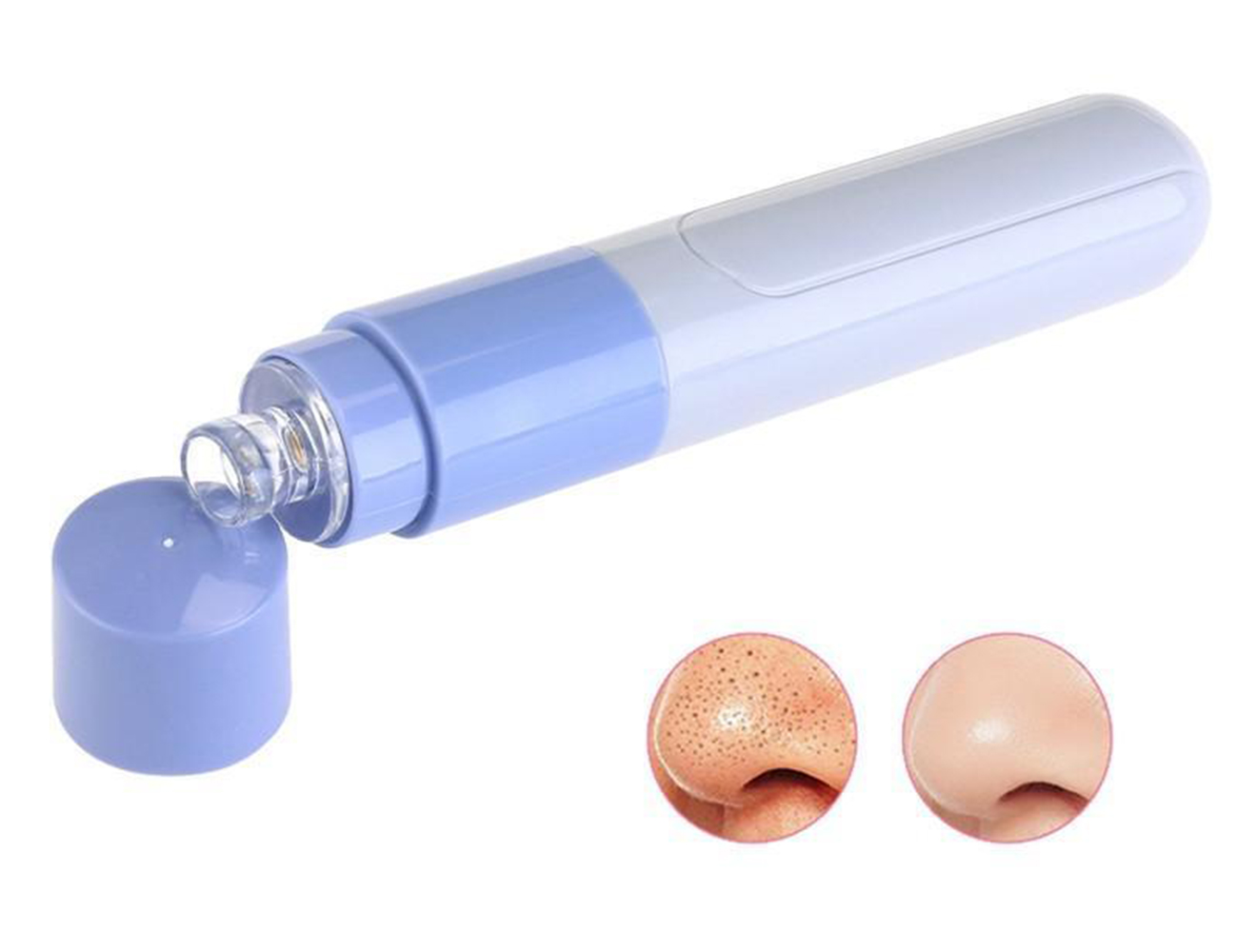 

Elitzia ETZ21 Mini Blackhead Remover Tool Face Massager Facial Pore Cleaner