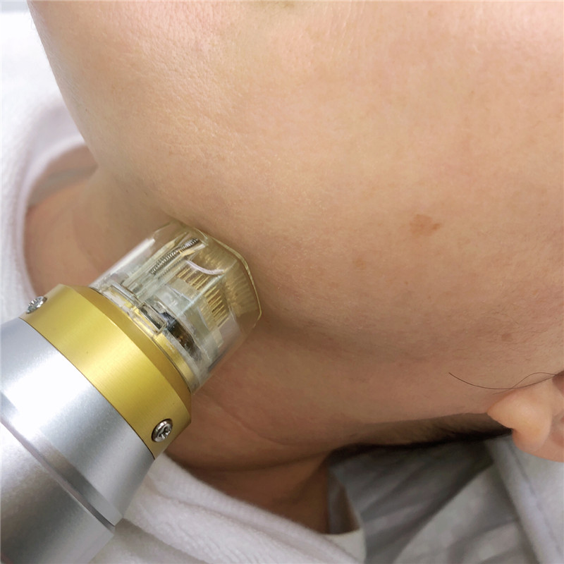 

Best facial beauty equipment radio frequency micro needle rf fractional & fractional rf microneedle for fave lifting