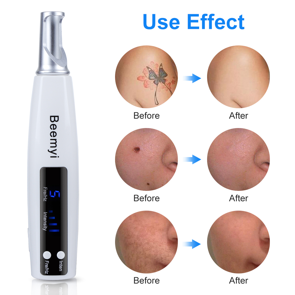 

Blue Ray Picosecond Laser Pen Scar Spot Freckle Skin Tag Removal Tattoo Melanin Diluting Machine With Protective Eyeglass Device