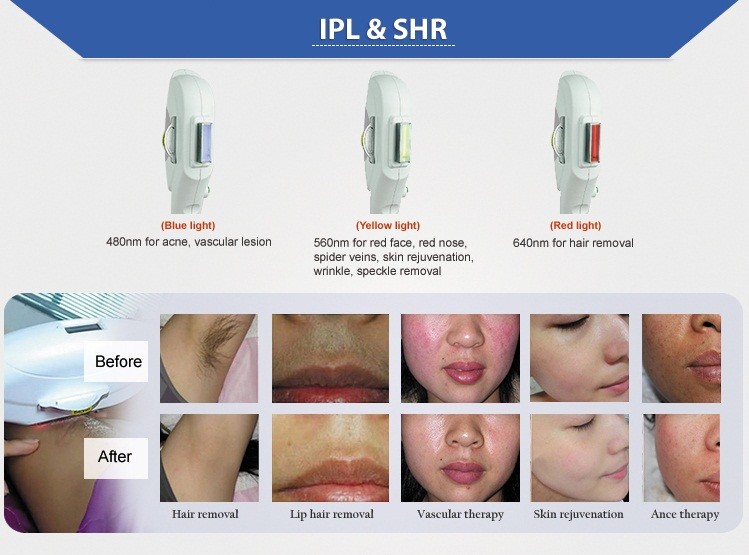 Portable home use opt ipl laser hair removal machine