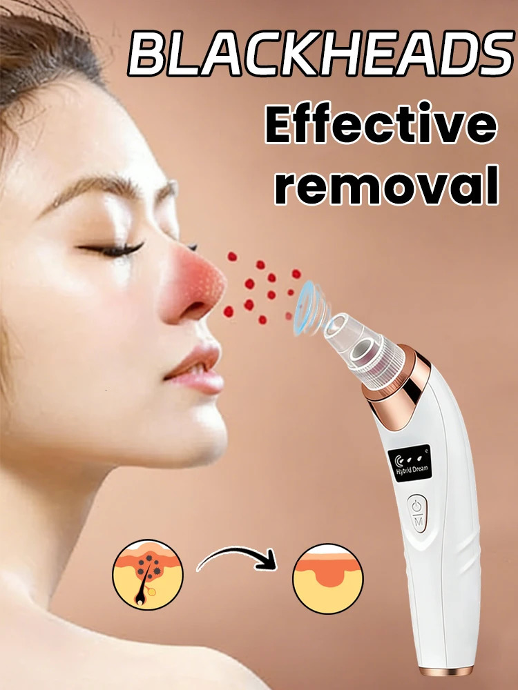 Electric Blackhead Remover Vacuum Cleaner Black Dots Vacuum Cleaner Skin Pimple ctor Cleaning Electric 260424