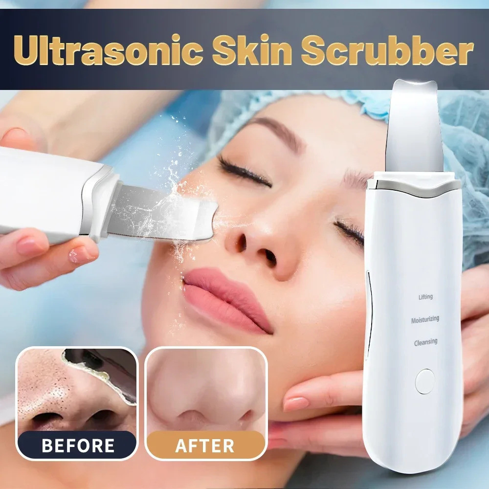 Professional No Ultrasonic Facial Skin Scrubber Ion Deep Face Cleaning Peeling Rechargeable Skin Care Device Beauty Instrument 260612