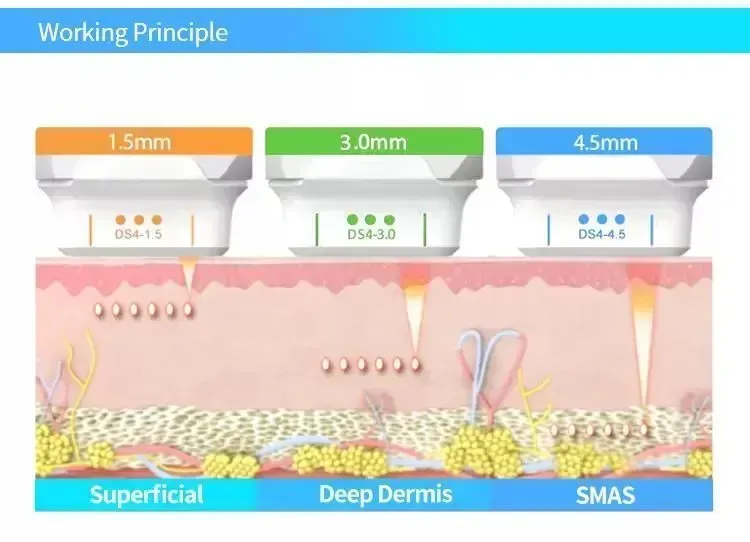 2021 Portable Mini Cost-effective Technology 2D Hifu focused ultrasound Machine For wrinkle removal