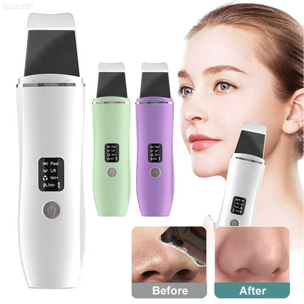 Electric Face Scrubbers Ultrasonic Skin Scrubber Peeling Blackhead Remover Deep Face Cleaning Ultrasonic Ion Cleaner Facial Beauty Face Cleaner L-image-904238419
