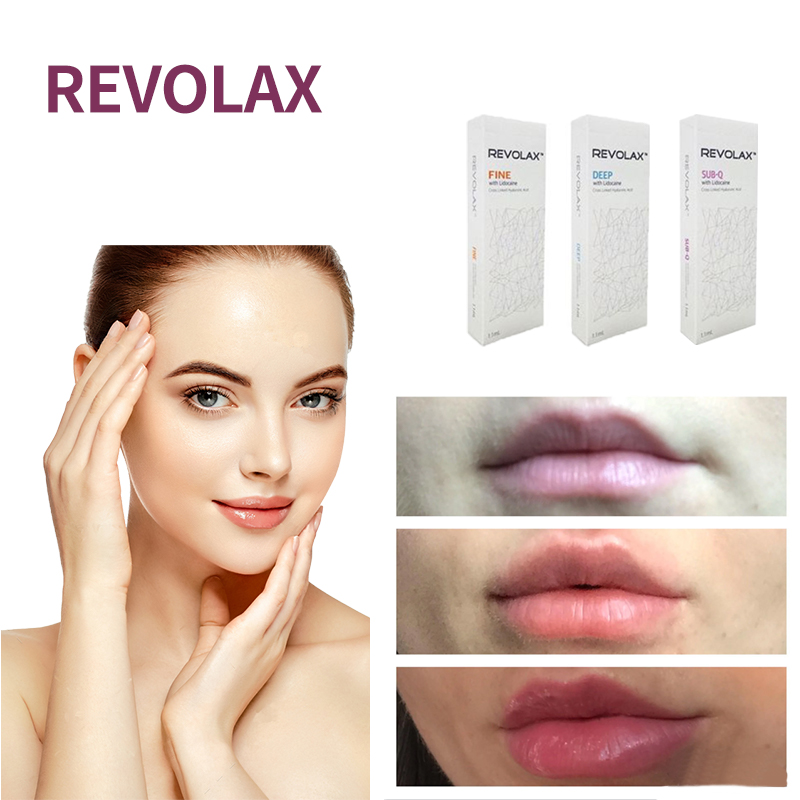 

dermal filler Neuramis revolax yvoire restylane 1ML fine deep volume for lip nose enhance face filling anti aging injection