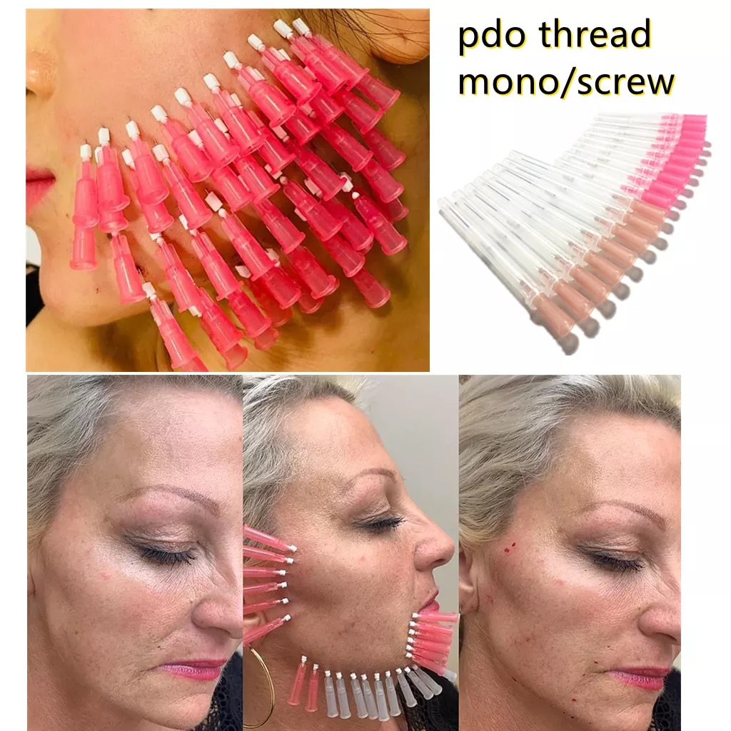 PDO Threads Mono screw face lifting needle 30G 29G 27G 26G 13mm 25mm 38mm 60mm Wires Hilos Tensore Fill Face Lift Tornado Screw PCL PLLA-image-838963572